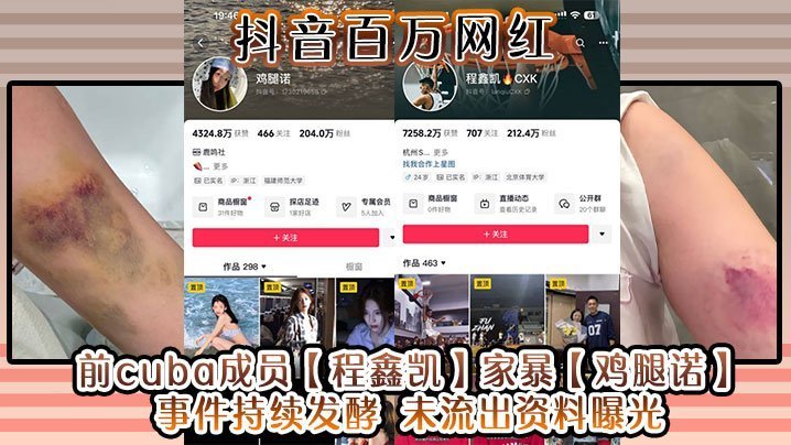 抖音百万网红前cuba成员程鑫凯家暴鸡腿诺事件持续发酵未流出资料曝光